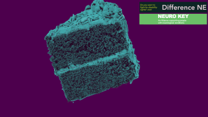 Disability Community Stockton-on-tees, Graphic promoting Stockton health challenges discussion. Blue slice of cake on a purple background. NeuroKey and Difference NE logo visible in the top right.